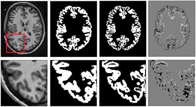 vol2Brain: A New Online Pipeline for Whole Brain MRI Analysis